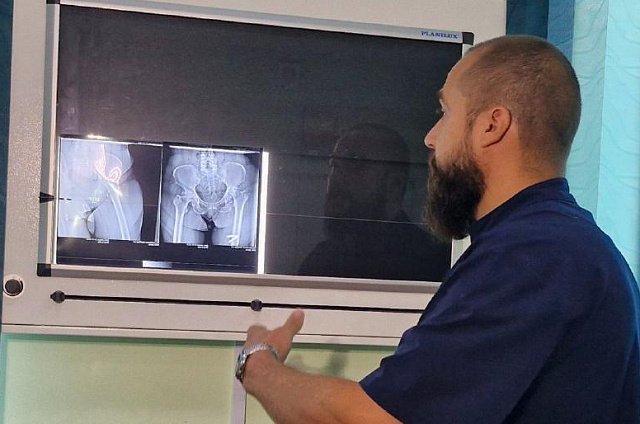 Замена сустава за час: жителям Приамурья доступны сложные операции бесплатно 