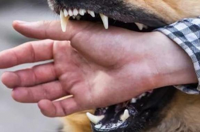 Администрация Сковородинского округа выплатит подростку моральную компенсацию за укус собаки