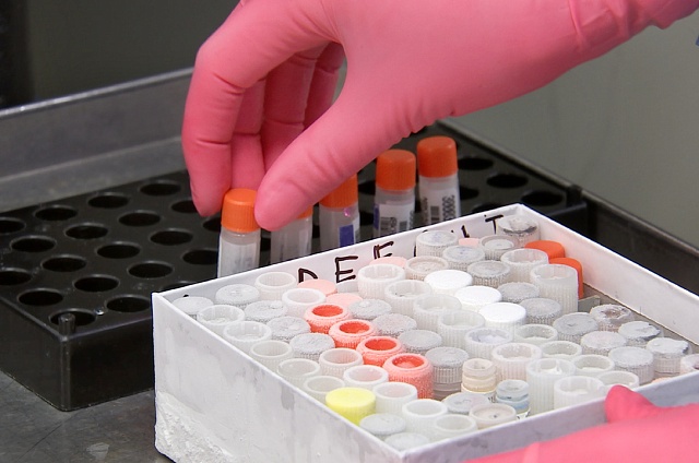 Учёные совершили прорыв в редактировании хромосом при синдроме Дауна