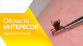 Область интересов. Удаление клеща