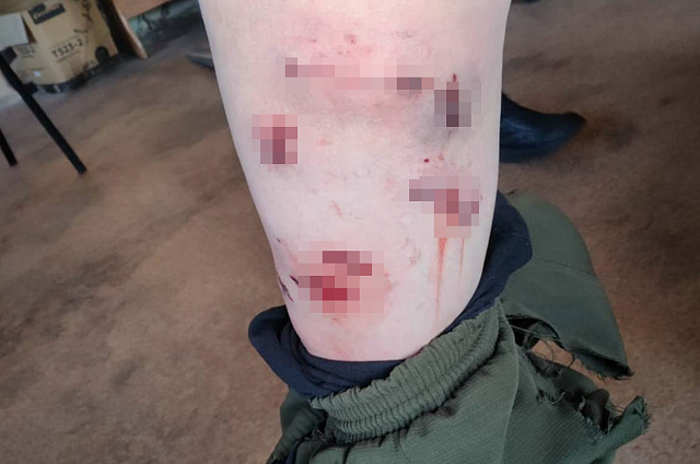 Служебное расследование после нападения собак на мужчину начали в Белогорске