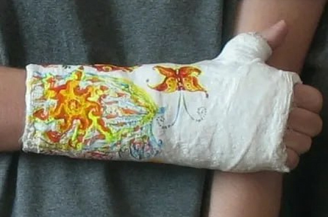 Компенсацию морального вреда получит школьница из Уруши за полученный перелом